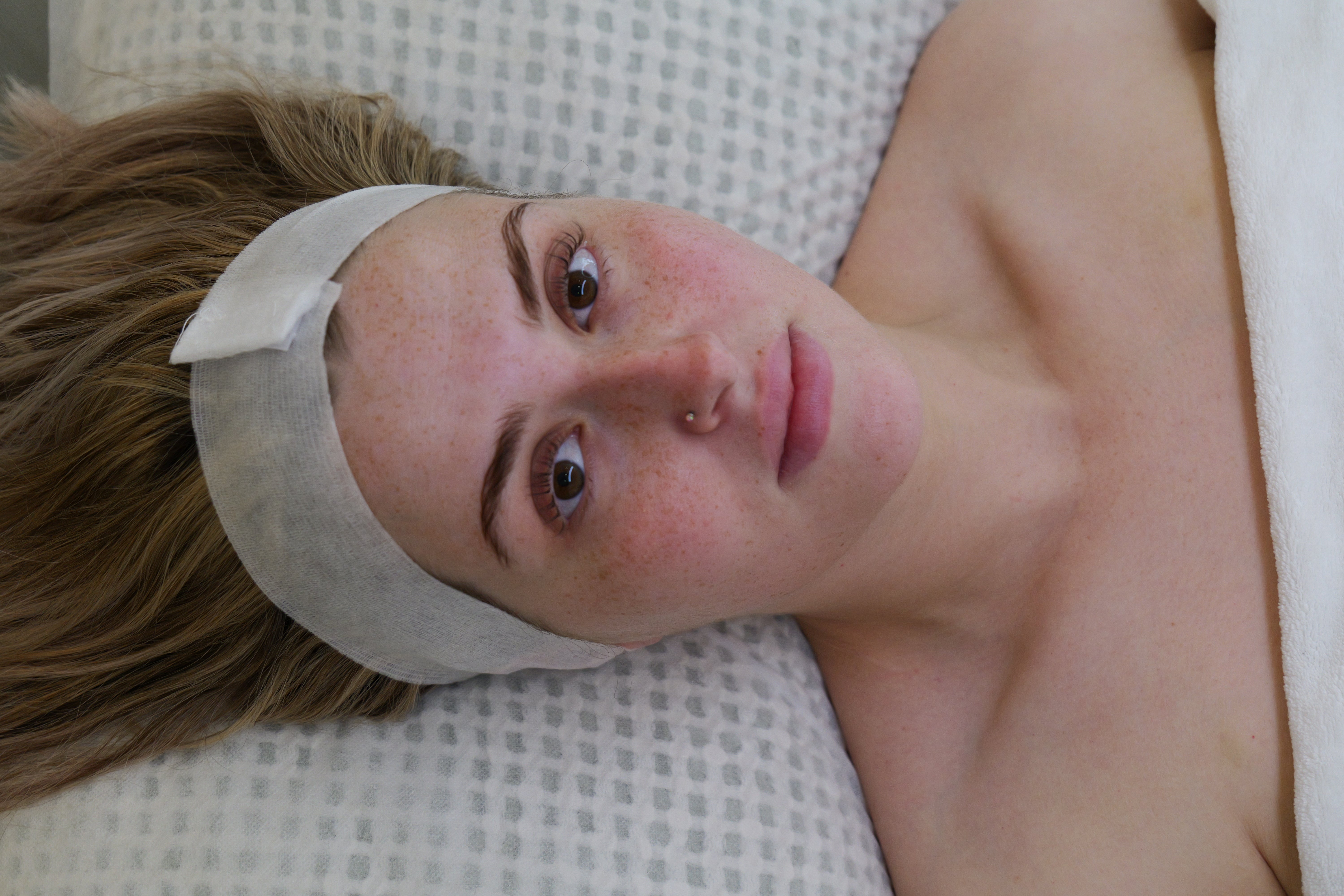 Before Ultimate Glow Facial