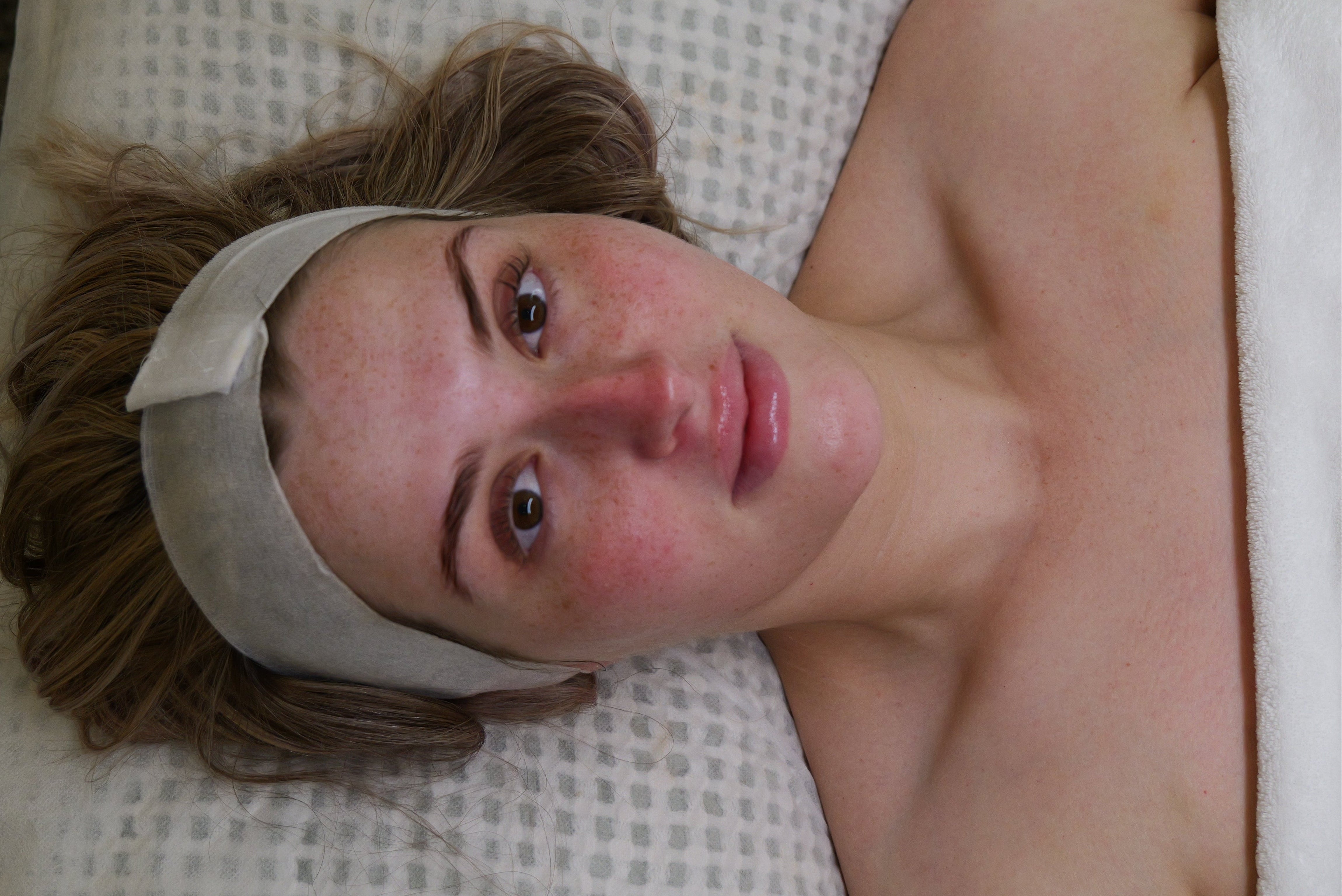After Ultimate Glow Facial